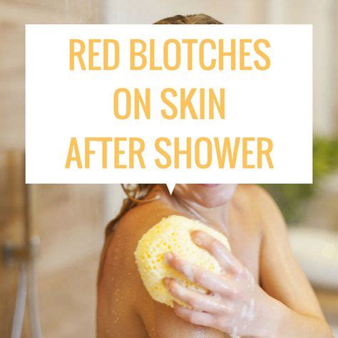 red blotches on skin after shower